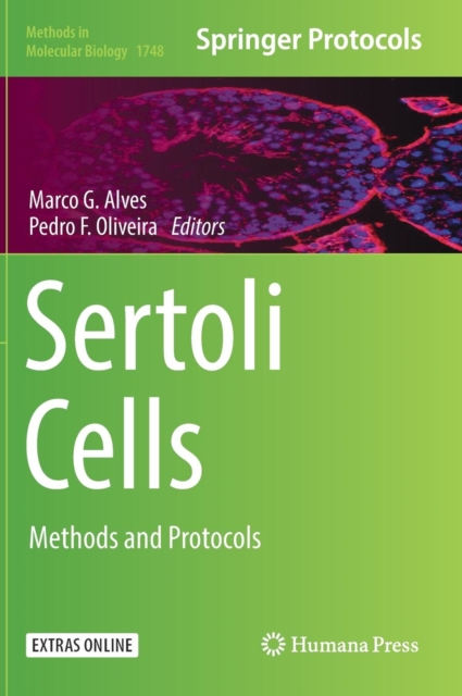 Sertoli Cells