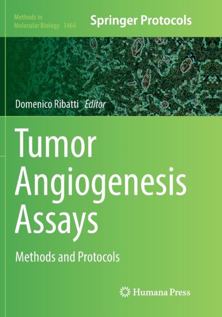 Tumor Angiogenesis Assays