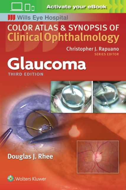 Glaucoma