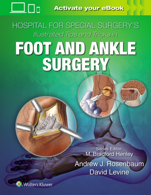 Hospital for Special Surgery's Illustrated Tips and Tricks in Foot and Ankle Surgery