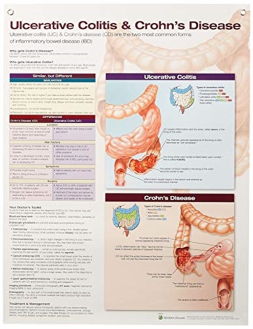 Ulcerative Colitis & Crohn's Disease Anatomical Chart Laminated