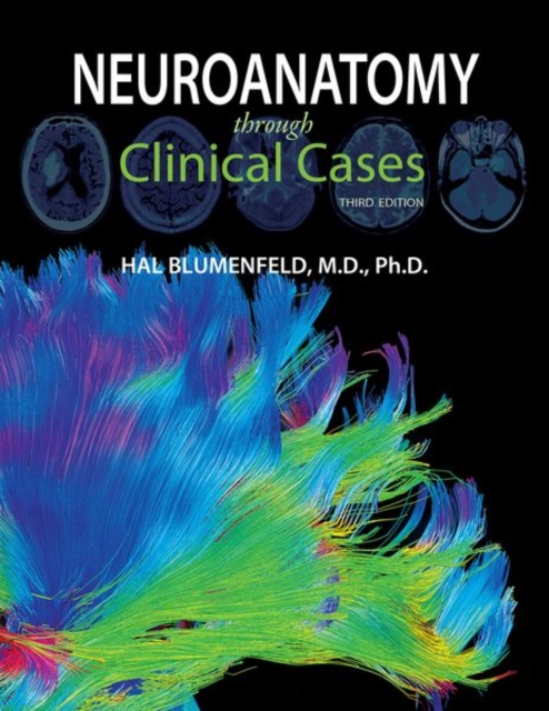 Neuroanatomy through Clinical Cases