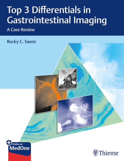 Top 3 Differentials in Gastrointestinal Imaging