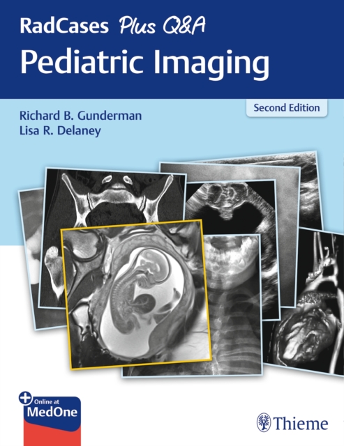 RadCases Plus Q&a Pediatric Imaging