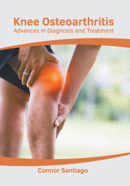 Knee Osteoarthritis: Advances in Diagnosis and Treatment