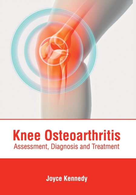 Knee Osteoarthritis: Assessment, Diagnosis and Treatment