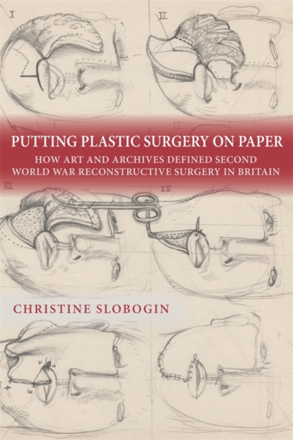 Putting Plastic Surgery on Paper