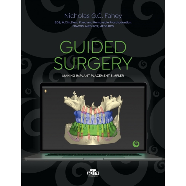 Guided Surgery