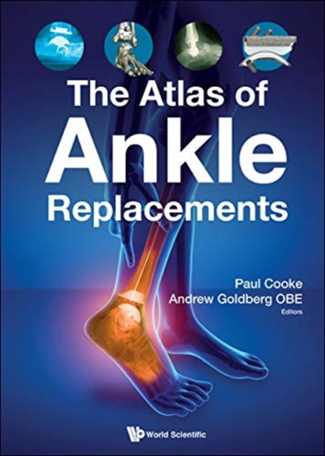 Atlas Of Ankle Replacements, The