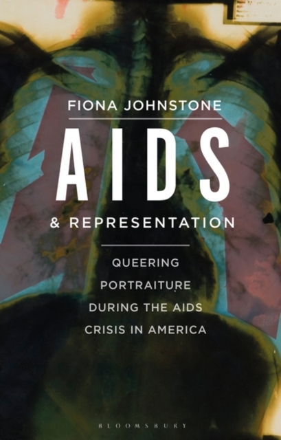 AIDS and Representation