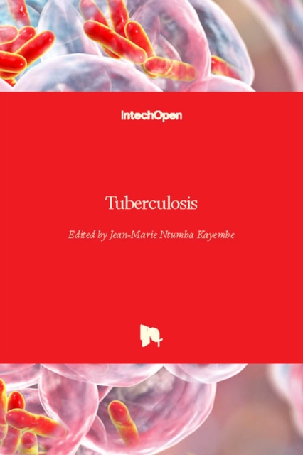 Tuberculosis