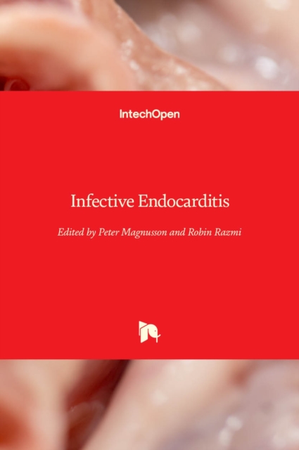 Infective Endocarditis