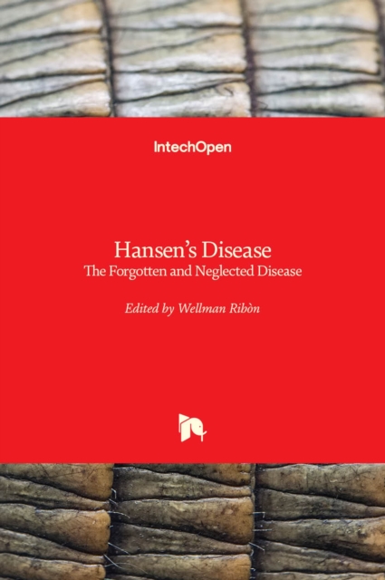 Hansen's Disease