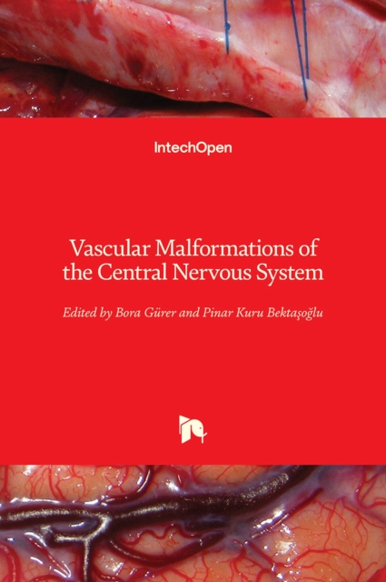 Vascular Malformations of the Central Nervous System