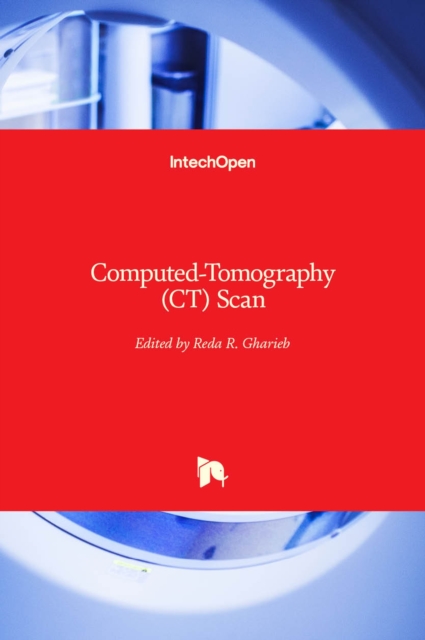 Computed-Tomography (CT) Scan