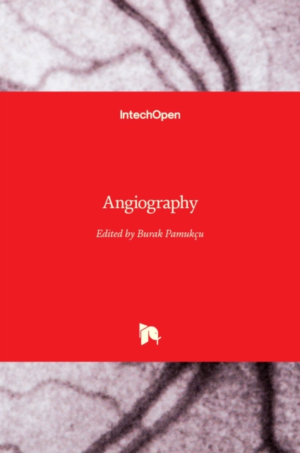 Angiography