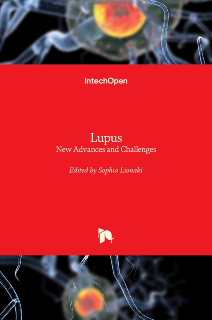 Lupus