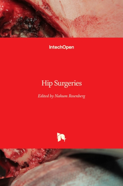 Hip Surgeries