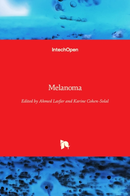 Melanoma