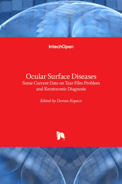 Ocular Surface Diseases