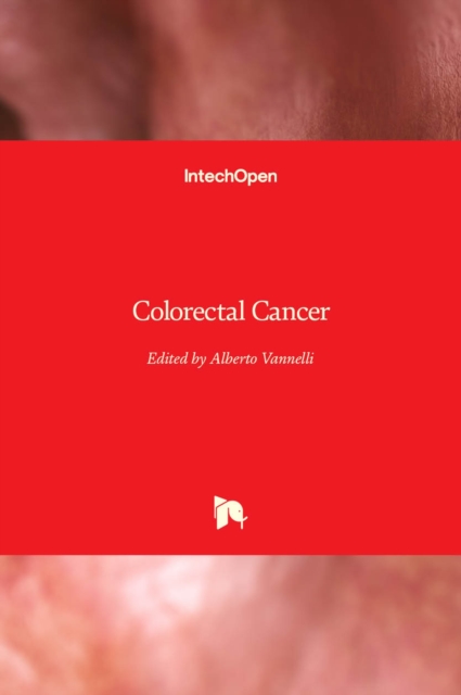 Colorectal Cancer