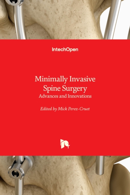 Minimally Invasive Spine Surgery