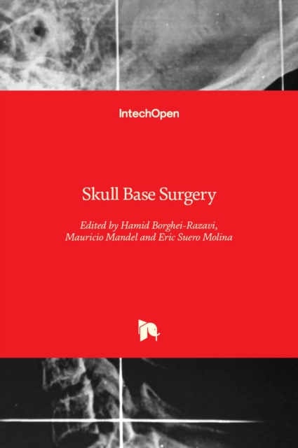 Skull Base Surgery