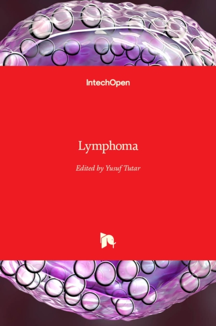 Lymphoma