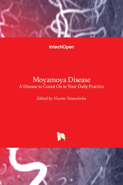 Moyamoya Disease