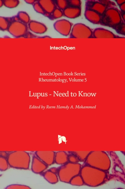 Lupus