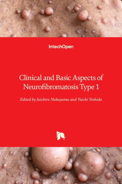 Clinical and Basic Aspects of Neurofibromatosis Type 1