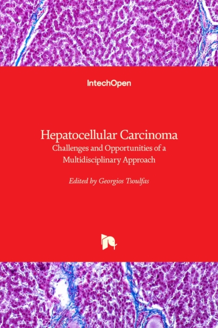 Hepatocellular Carcinoma