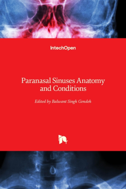 Paranasal Sinuses Anatomy and Conditions