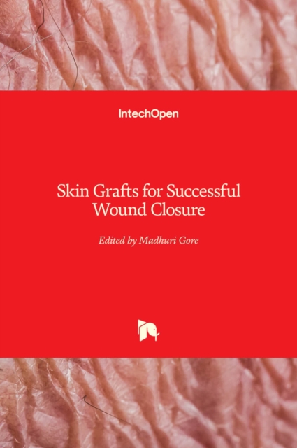 Skin Grafts for Successful Wound Closure