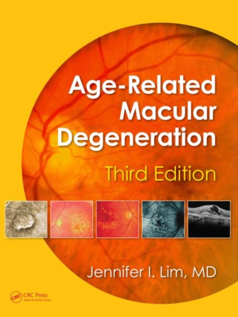 Age-Related Macular Degeneration, Third Edition