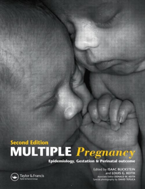 Multiple Pregnancy