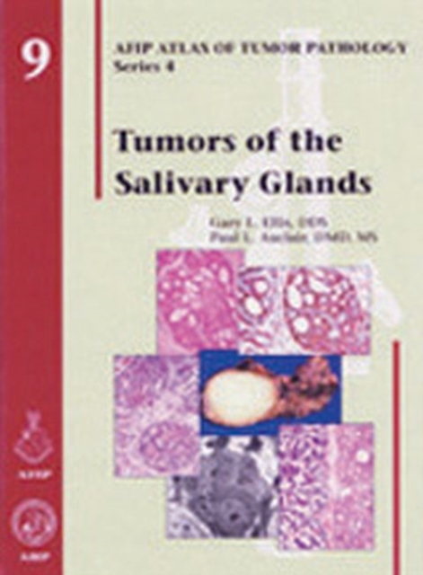 Tumors of the Salivary Glands