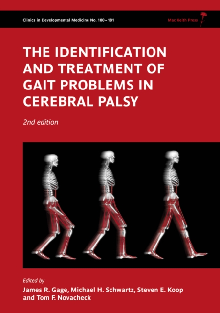 Identification and Treatment of Gait Problems in Cerebral Palsy