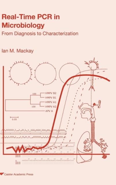 Real-time PCR in Microbiology