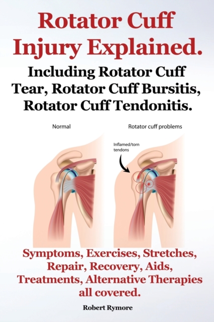 Rotator Cuff Injury Explained. Including Rotator Cuff Tear, Rotator Cuff Bursitis, Rotator Cuff Tendonitis. Symptoms, Exercises, Stretches, Repair, Recovery, Aids, Treatments, Alternative Therapies all covered.