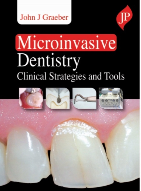 Microinvasive Dentistry