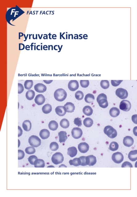 Fast Facts: Pyruvate Kinase Deficiency