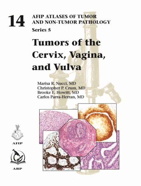 Tumors of the Cervix, Vagina, and Vulva