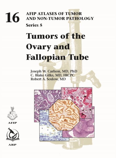 Tumors of the Ovary and Fallopian Tube