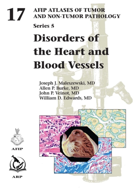 Disorders of the Heart and Blood Vessels