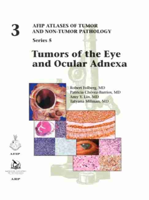 Tumors of the Eye and Ocular Adnexa