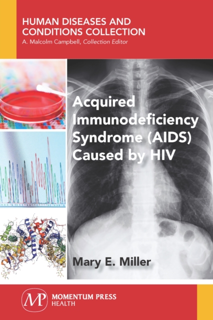 Acquired Immunodeficiency Syndrome (AIDS) Caused by HIV