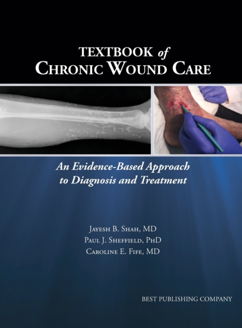 Textbook of Chronic Wound Care