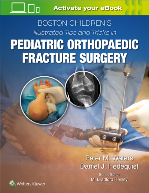 Boston Children’s Illustrated Tips and Tricks  in Pediatric Orthopaedic Fracture Surgery