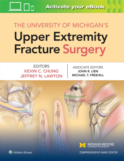 University of Michigan's Upper Extremity Fracture Surgery